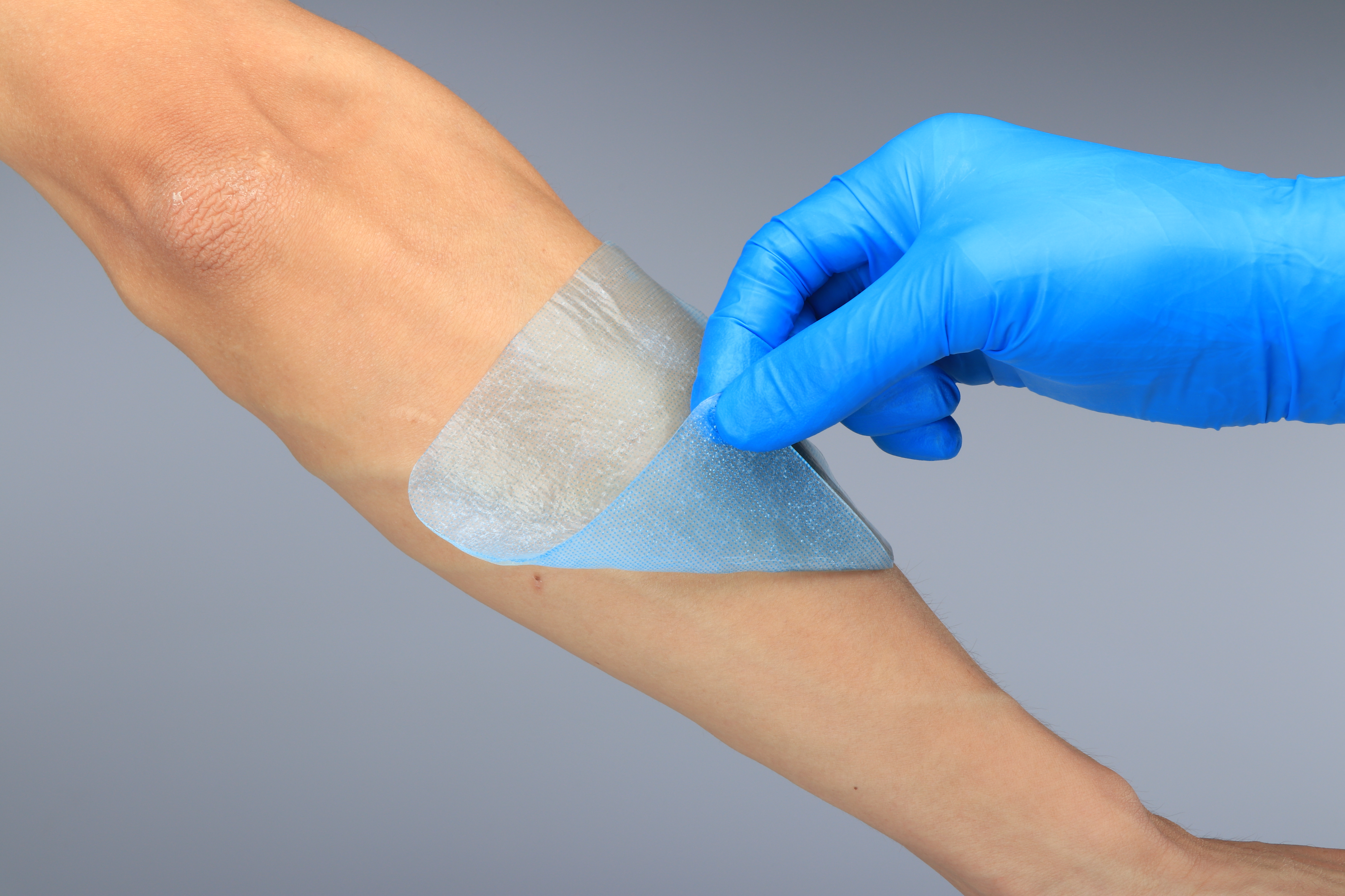 Absorbierender steriler medizinischer Hydrogel-Verband zur Behandlung kleinerer Verbrennungen