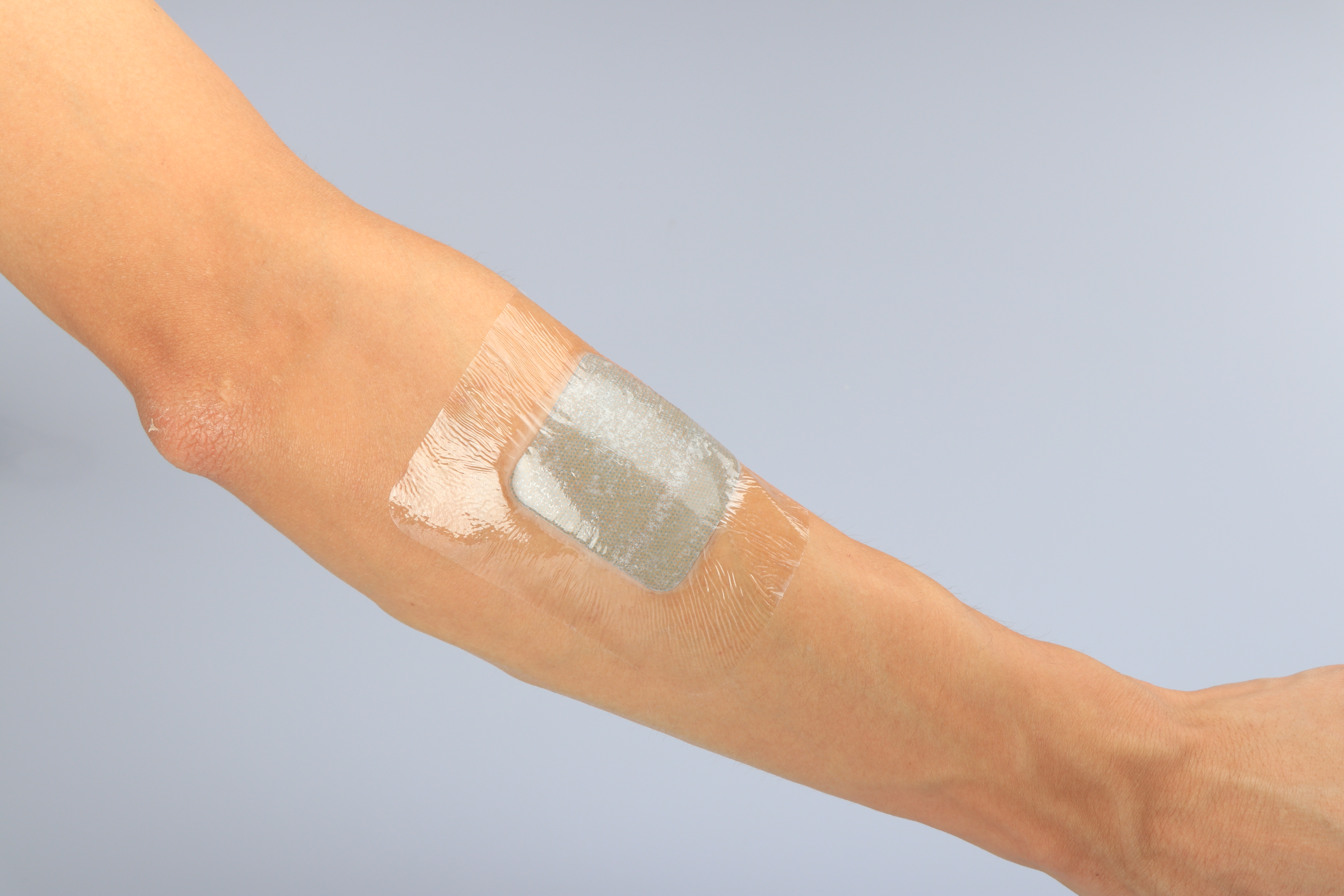 Absorbierender medizinischer Hydrogel-Verband für die Veterinärmedizin