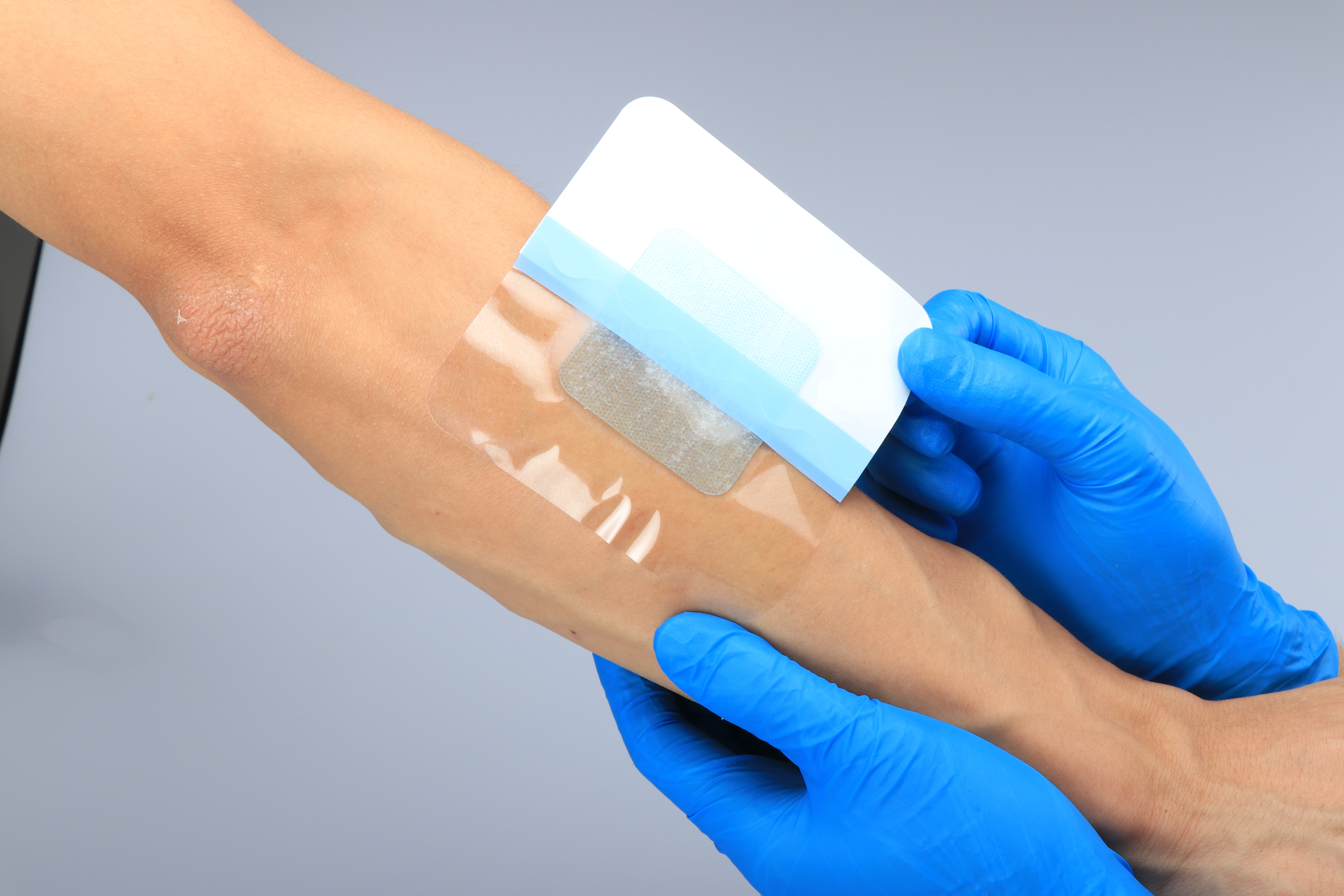 Absorbierender steriler medizinischer Hydrogel-Verband zur Behandlung kleinerer Verbrennungen