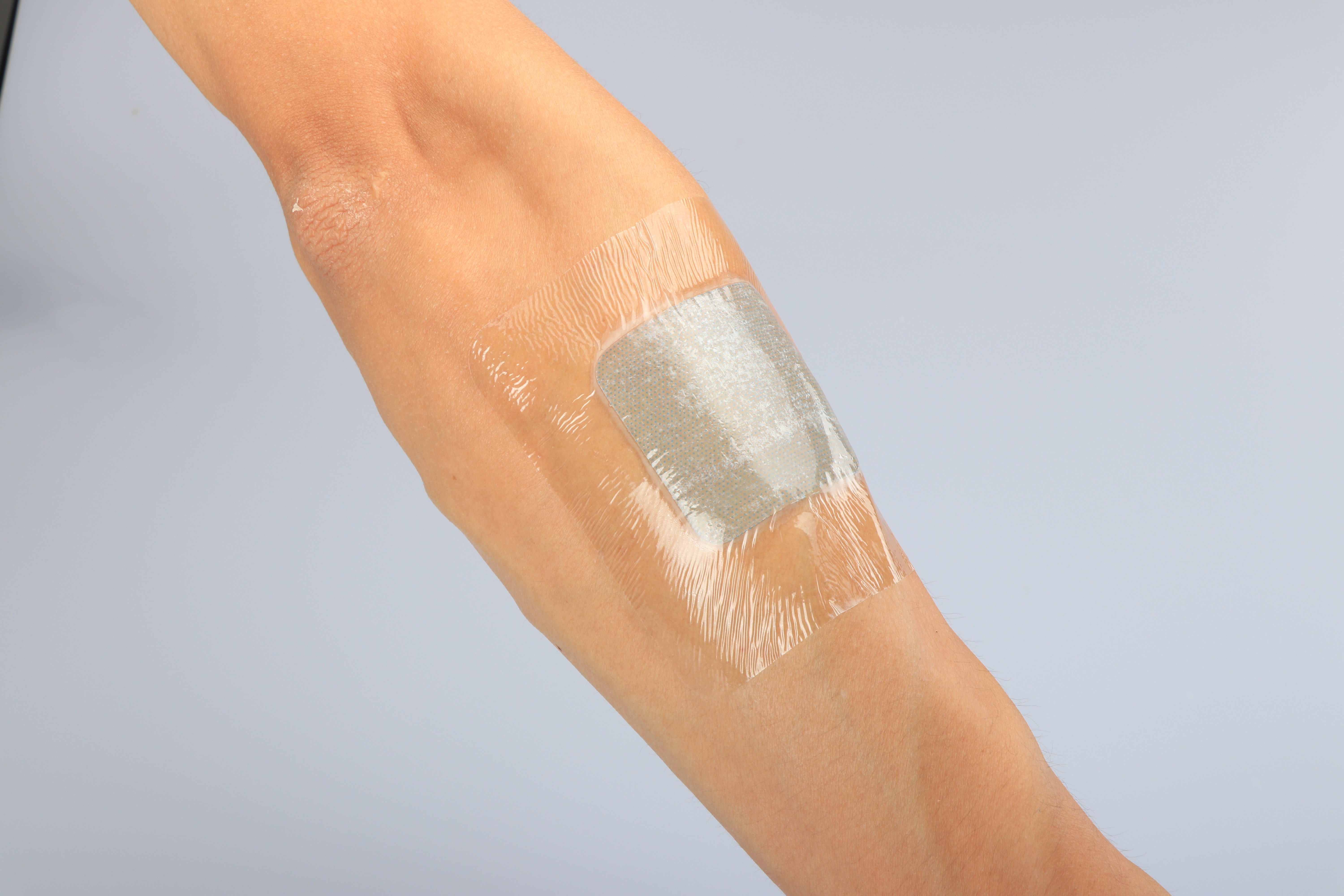 Druckgeschwüre Keto-freundlicher medizinischer Hydrogel-Verband mit Klebstoff